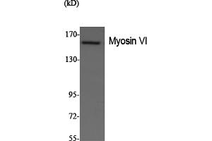 Western Blotting (WB) image for anti-Myosin VI (MYO6) antibody (ABIN5958676) (Myosin VI 抗体)