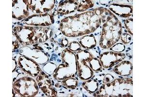 Immunohistochemistry (IHC) image for anti-Induced Myeloid Leukemia Cell Differentiation Protein Mcl-1 (MCL1) antibody (ABIN1499341) (MCL-1 抗体)