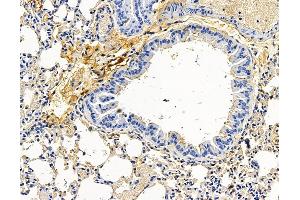 ABIN7096583 and ABIN7100647 at 1/100 staining mouse lung tissue by IHC-P. (RUFY3 抗体)