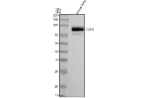 Western blot analysis of Cdh5 using anti-Cdh5 antibody (ABIN7606684).