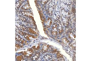 IHC analysis of SLC20A1 using anti-SLC20A1 antibody (ABIN7602463).
