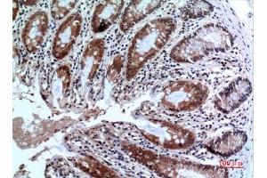 Immunohistochemical analysis of paraffin-embedded human-colon, antibody was diluted at 1:100. (FOXP3 抗体  (C-Term))