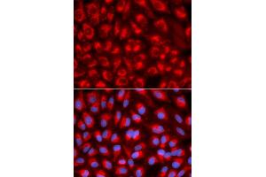 Immunofluorescence analysis of U2OS cells using TFAM antibody (ABIN5970991). (TFAM 抗体)