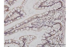 Image no. 2 for anti-GA Binding Protein Transcription Factor, alpha Subunit 60kDa (GABPA) (AA 1-101) antibody (ABIN598704) (GABPA 抗体  (AA 1-101))