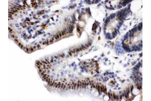 Visfatin was detected in paraffin-embedded sections of rat intestine tissues using rabbit anti- Visfatin Antigen Affinity purified polyclonal antibody (Catalog # ) at 1 µg/mL. (NAMPT 抗体  (AA 62-337))