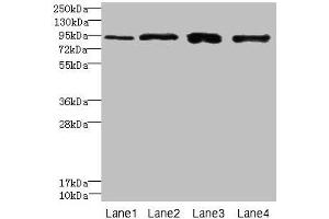 Western blot All lanes: XRRA1 antibody at 6 μg/mL Lane 1: HepG2 whole cell lysate Lane 2: Mouse kidney tissue Lane 3: HL60 whole cell lysate Lane 4: U251 whole cell lysate Secondary Goat polyclonal to rabbit IgG at 1/10000 dilution Predicted band size: 90, 68, 89, 84, 59 kDa Observed band size: 90 kDa (XRRA1 抗体  (AA 101-400))