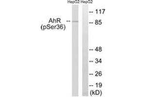 Western blot analysis of extracts from HepG2 cells, using AhR (Phospho-Ser36) Antibody. (Aryl Hydrocarbon Receptor 抗体  (pSer36))