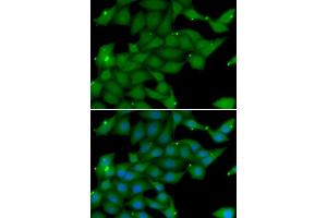 Immunofluorescence analysis of U20S cell using RASGRF1 antibody. (RASGRF1 抗体)