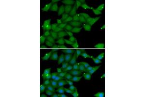 Immunofluorescence analysis of U20S cell using RASGRF1 antibody. (RASGRF1 抗体)