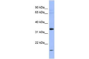 WB Suggested Anti-PYCR1  Antibody Titration: 0. (PYCR1 抗体  (Middle Region))
