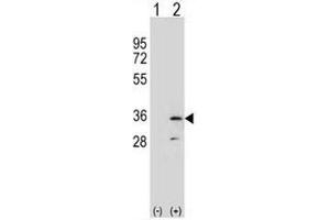 Western blot analysis of RPA2 (arrow) using rabbit polyclonal RPA2 Antibody (N-term) . (RPA2 抗体  (N-Term))