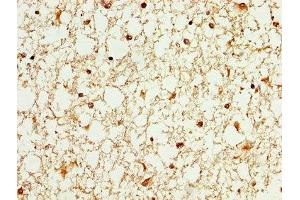 IHC image of ABIN7175838 diluted at 1:100 and staining in paraffin-embedded human brain tissue performed on a Leica BondTM system. (WASF3 抗体  (AA 368-502))