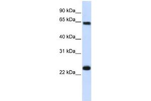 Karyopherin Alpha 1 antibody used at 1 ug/ml to detect target protein. (KPNA1 抗体)