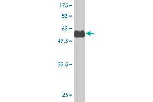 Western Blot detection against Immunogen (53. (SNX29 抗体  (AA 1-249))