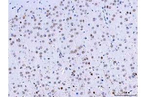 IHC analysis of HnRNP H/HNRNPH1 using anti-HnRNP H/HNRNPH1 antibody (ABIN4886623). (HNRNPH1 抗体  (N-Term))