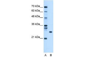 RBPMS antibody used at 1. (RBPMS 抗体  (N-Term))