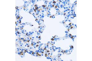 Immunohistochemistry of paraffin-embedded Rat lung using EE antibody  at dilution of 1:100 (40x lens). (EEA1 抗体  (AA 1182-1411))