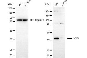 Western blotting analysis using GOT1 antibody (ABIN7798745). (GOT1 抗体)