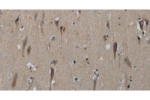 Immunohistochemistry of paraffin-embedded Human brain tissue using HSPG2 Polyclonal Antibody at dilution 1:50 (HSPG2 抗体)