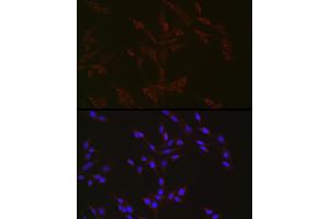 Immunofluorescence analysis of PC-12 cells using Niemann Pick C1 antibody (ABIN7268911) at dilution of 1:50.