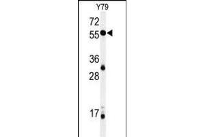 Western blot analysis of NOB1 Antibody (C-term) (ABIN651015 and ABIN2840039) in Y79 cell line lysates (35 μg/lane). (NOB1 抗体  (C-Term))