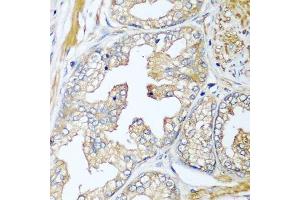 Immunohistochemistry of paraffin-embedded human prostate using CFD antibody. (Adipsin 抗体  (AA 26-253))