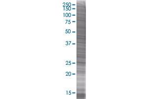 SRD5A1 transfected lysate (SRD5A1 293T Cell Transient Overexpression Lysate(Denatured))