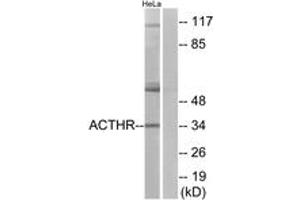 Western Blotting (WB) image for anti-Melanocortin 2 Receptor (Adrenocorticotropic Hormone) (MC2R) (AA 248-297) antibody (ABIN2890808) (MC2R 抗体  (AA 248-297))