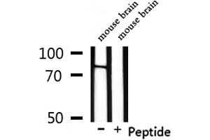 Western blot analysis of extracts from mouse brain, using NOL11 Antibody. (NOL11 抗体)