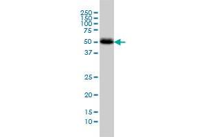 CANT1 monoclonal antibody (M01), clone 2D3 Western Blot analysis of CANT1 expression in A-431 . (CANT1 抗体  (AA 302-401))