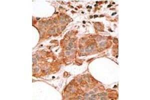 Image no. 2 for anti-BCL2-Like 14 (Apoptosis Facilitator) (BCL2L14) (BH3 Domain), (Isoform 3) antibody (ABIN356813)
