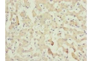 Immunohistochemistry of paraffin-embedded human liver tissue using ABIN7148369 at dilution of 1:100 (C8A 抗体  (AA 310-460))