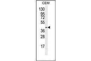 Western blot analysis of F8A2 Antibody (N-term) in CEM cell line lysates (35ug/lane). (F8A2 抗体  (N-Term))