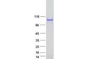 Western Blotting (WB) image for Ankyrin Repeat and SAM Domain-Containing Protein 3 (ANKS3) protein (Myc-DYKDDDDK Tag) (ABIN2714713)