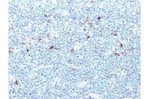Formalin-fixed, paraffin-embedded human tonsil stained with HLA-Aw32 / HLA-A25 antibody (CATA-1). (HLA-Aw32-&-HLA-A25 (MHC-I) 抗体)