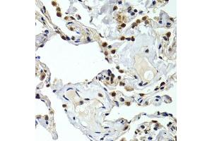 Immunohistochemistry of paraffin-embedded human normal lung using GTF2F1 antibody. (GTF2F1 抗体)