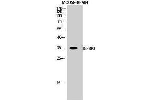 Western Blotting (WB) image for anti-Insulin-Like Growth Factor Binding Protein 3 (IGFBP3) (Ser53) antibody (ABIN3185137)