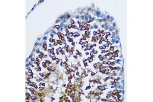 Immunohistochemistry of paraffin-embedded Rat testis using ST Rabbit pAb (ABIN1682908, ABIN1682909, ABIN5664112 and ABIN6219730) at dilution of 1:100 (40x lens). (STAT4 抗体  (AA 600-700))