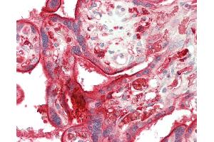 Human Placenta: Formalin-Fixed, Paraffin-Embedded (FFPE) (DAB2 抗体  (AA 743-770))
