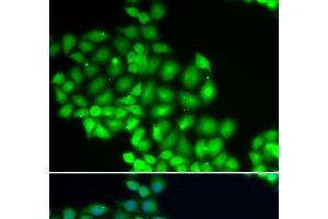 Immunofluorescence analysis of HeLa cells using ERCC2 Polyclonal Antibody (ERCC2 抗体)