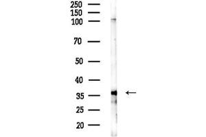 Western blot analysis of lysates from F10-LUC cells(starvation treatment), using NFKBIL1 Antibody at 1/1000 dilution.