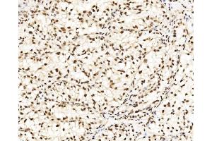 IHC analysis of DBC-1/CCAR2 using anti-DBC-1/CCAR2 antibody (ABIN7602235). (CCAR2 抗体  (AA 65-917))
