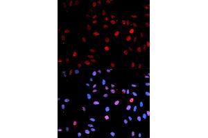 Immunofluorescence (IF) image for anti-Tumor Protein P53 (TP53) (pSer15) antibody (ABIN1870674) (p53 抗体  (pSer15))