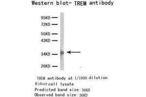 Western Blotting (WB) image for anti-Triggering Receptor Expressed On Myeloid Cells 1 (TREM1) antibody (ABIN1875201) (TREM1 抗体)