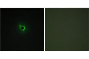 Immunofluorescence analysis of COS7 cells, using EPHA6 Antibody. (EPH Receptor A6 抗体  (AA 891-940))