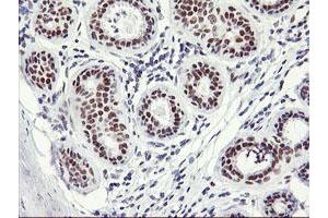 Immunohistochemical staining of paraffin-embedded Human breast tissue using anti-OBFC2B mouse monoclonal antibody. (SSBP1 抗体)