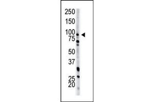 Image no. 1 for anti-phosphofructokinase, Muscle (PFKM) (N-Term) antibody (ABIN360632) (PFKM 抗体  (N-Term))