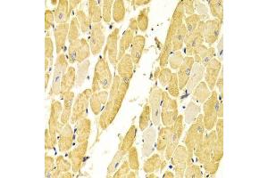 Immunohistochemistry (Paraffin-embedded Sections) (IHC (p)) image for anti-Carbonic Anhydrase III (CA3) (AA 1-260) antibody (ABIN3021739)
