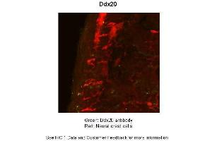Sample Type :  Mouse Gut Tissue TgWnt1-Cre/+ Ednrbflex3/+ Rosa26YFPStop/YFPStop  Primary Antibody Dilution :  1:50  Secondary Antibody :  Goat anti-rabbit-cy3  Secondary Antibody Dilution :  1:1500  Color/Signal Descriptions :  Ddx20: Green Neural crest cells:: Red  Gene Name :  Ddx20  Submitted by :  Anonymous (DDX20 抗体  (N-Term))