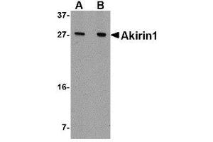 Western blot analysis of Akirin1 in A549 cell lysate with AP30038PU-N Akirin1 antibody at (A) 1 and (B) 2 μg/ml. (Akirin 1 抗体  (N-Term))